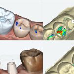 SOFTWARE DENTBIRD CAD CON AI